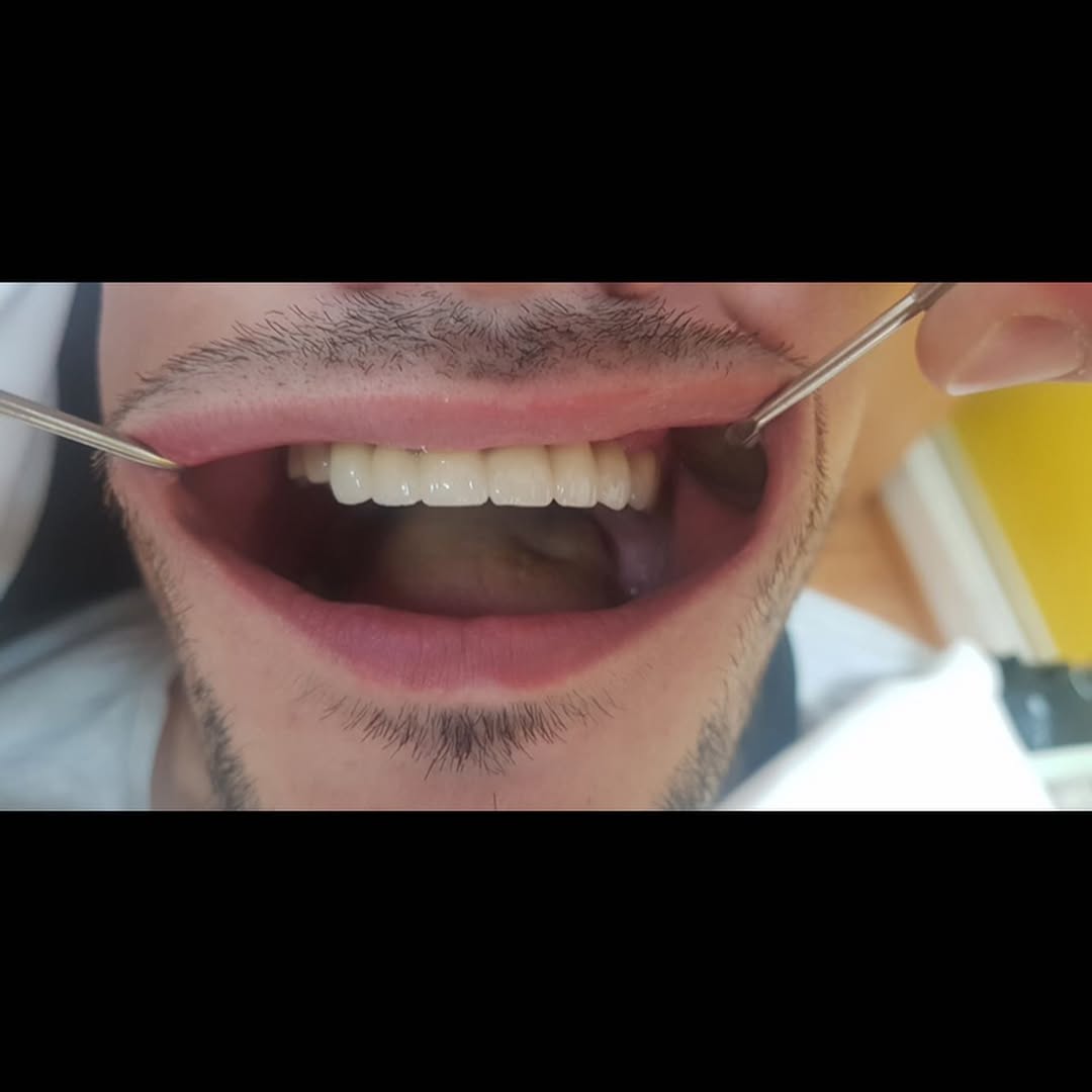 After image