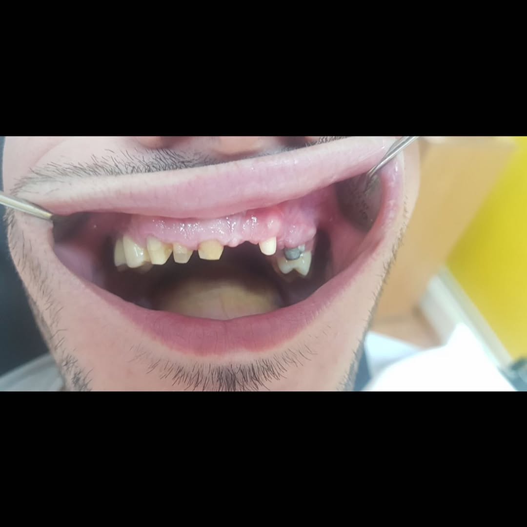 Before image