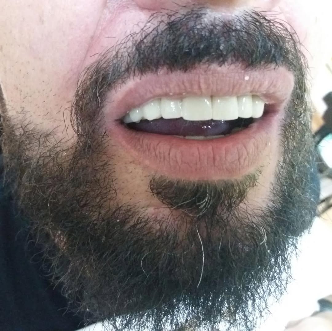 After image