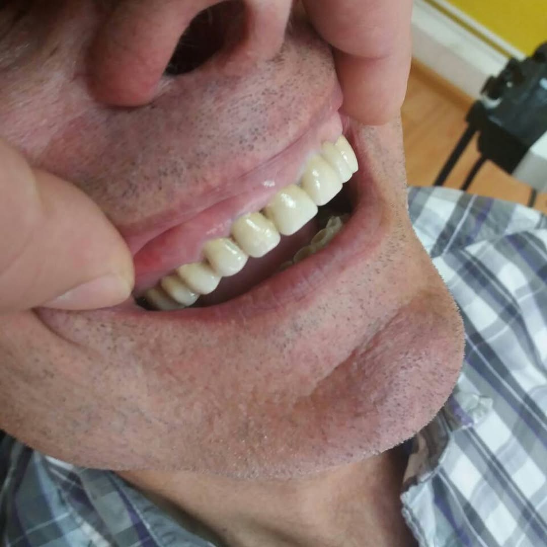 After image