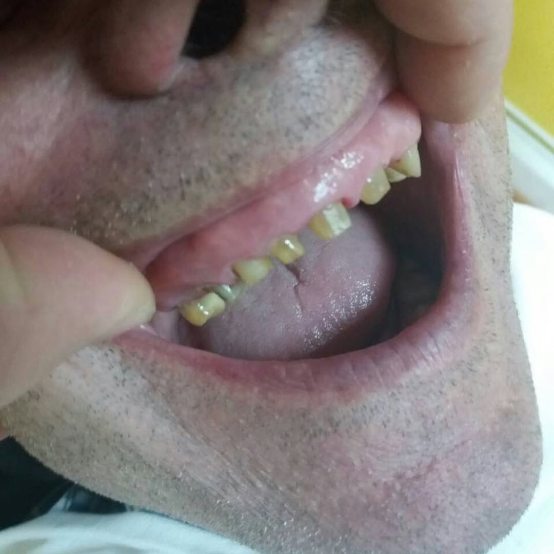 Before image
